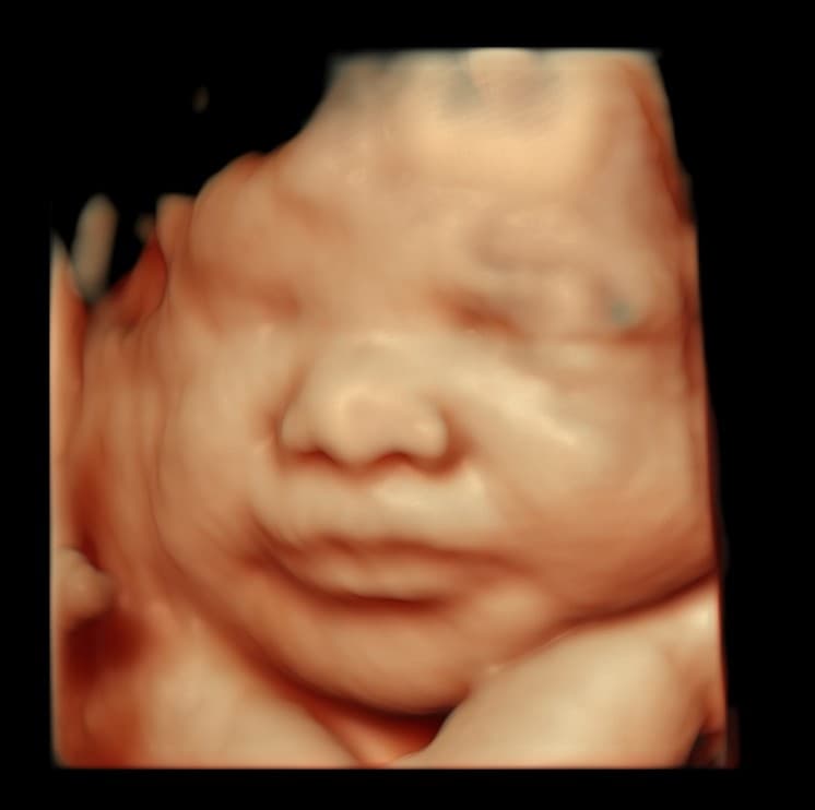 Close-up HD ultrasound image of a baby's peaceful face with soft cheeks and lips