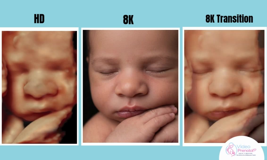 HD to 8K hyperrealistic transition of a baby resting chin on hand