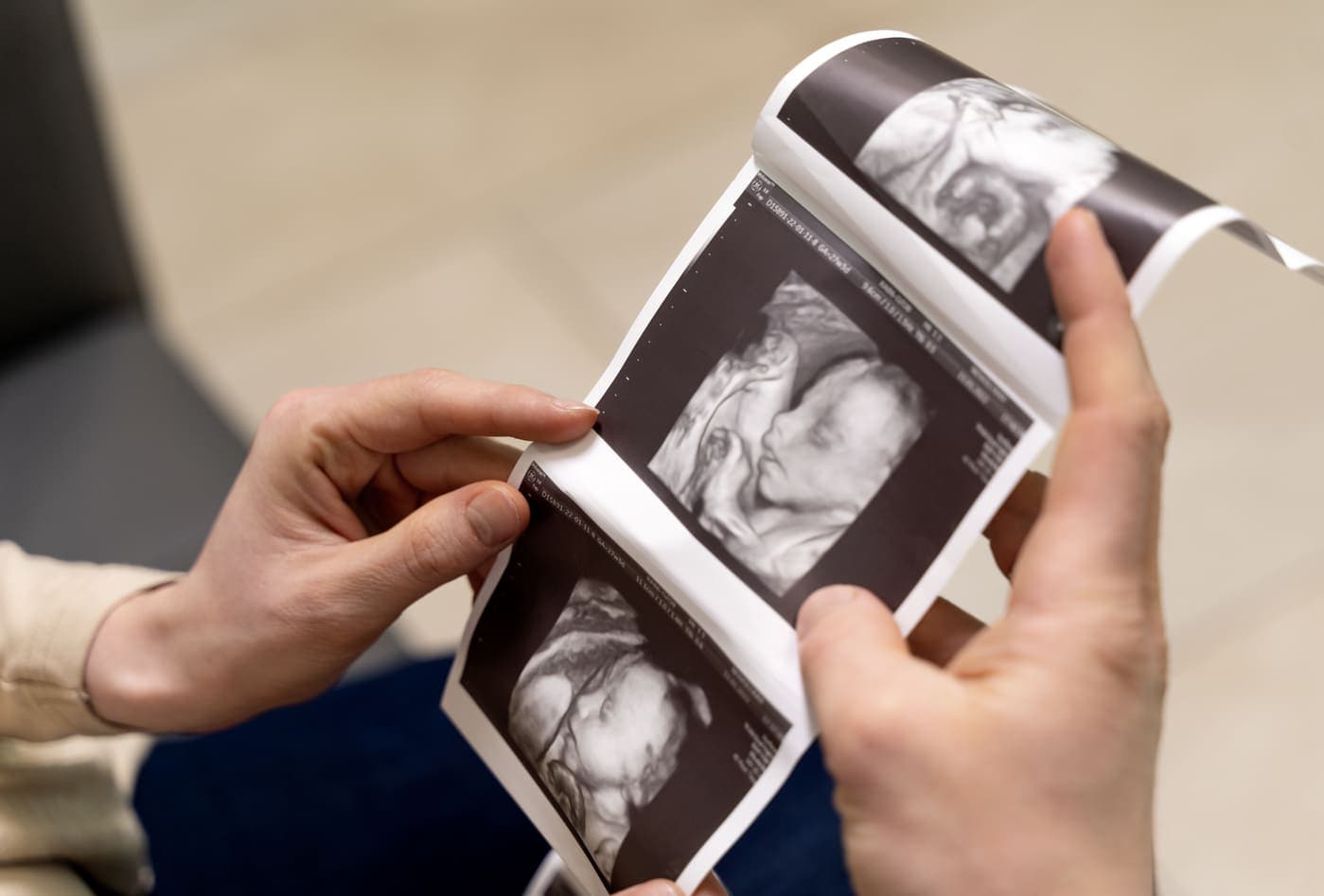 Parents holding a strip of printed 3D ultrasound pictures of their baby's face
