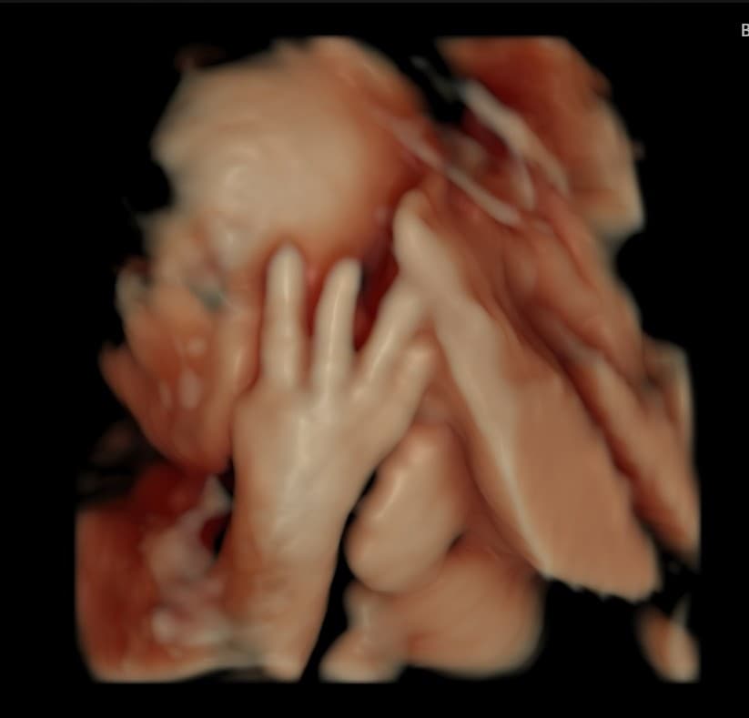 HD ultrasound of a baby holding a hand up to the face, with detailed fingers and soft lighting