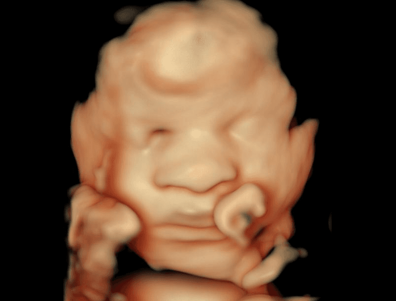 Good fluid baby ultrasound, clear face