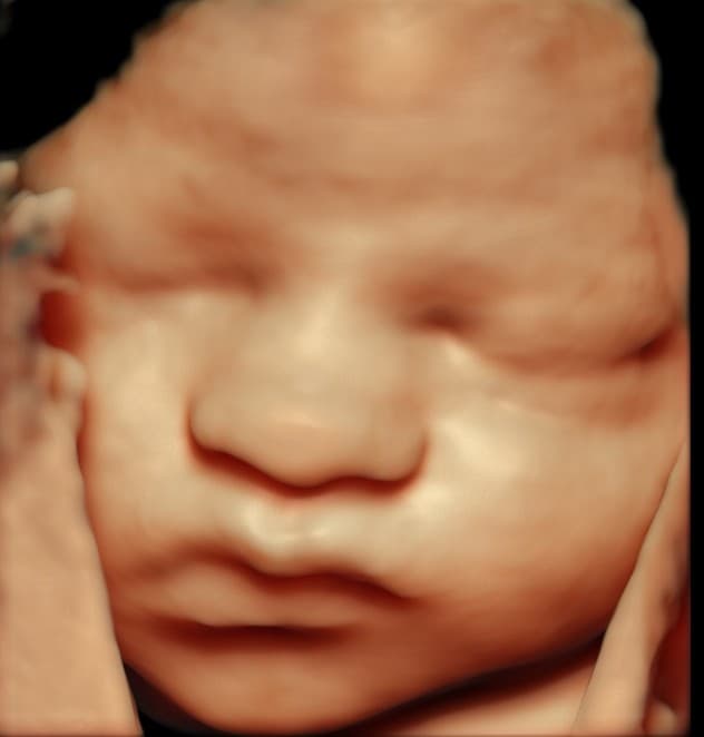 5D HD ultrasound of calm baby face resting on hand