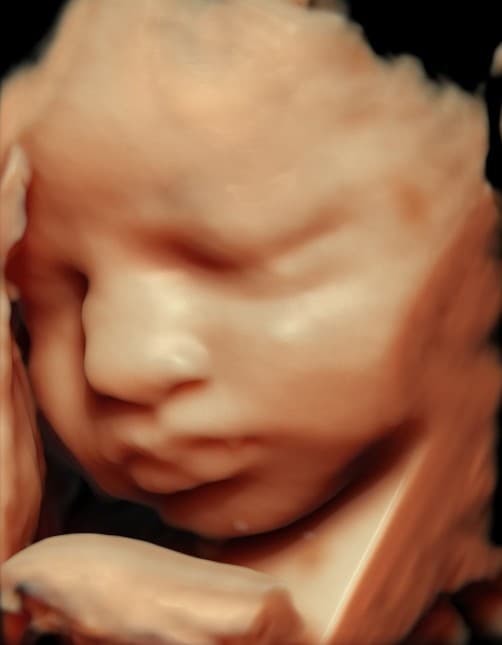 5D HD close-up ultrasound of baby's face profile
