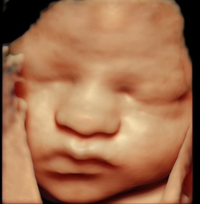 5D HD ultrasound of baby's peaceful sleeping face
