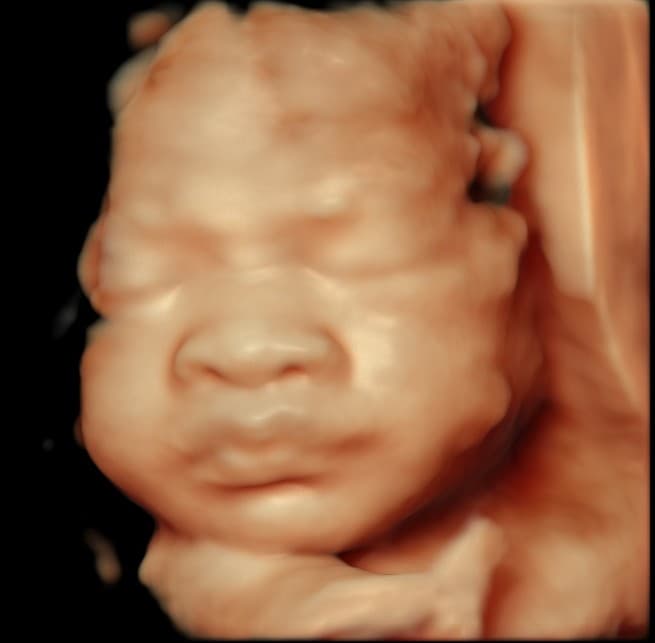 5D HD ultrasound of baby's calm resting face, side profile