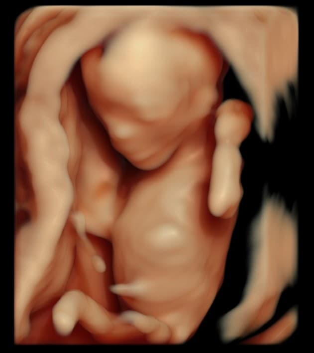 5D HD ultrasound of baby's full body in a curled pose