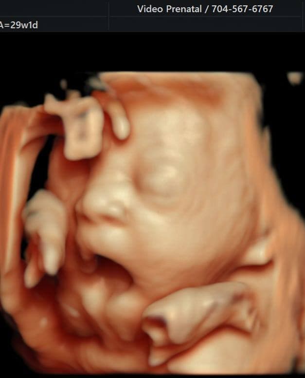 5D ultrasound of a baby with hands near the face