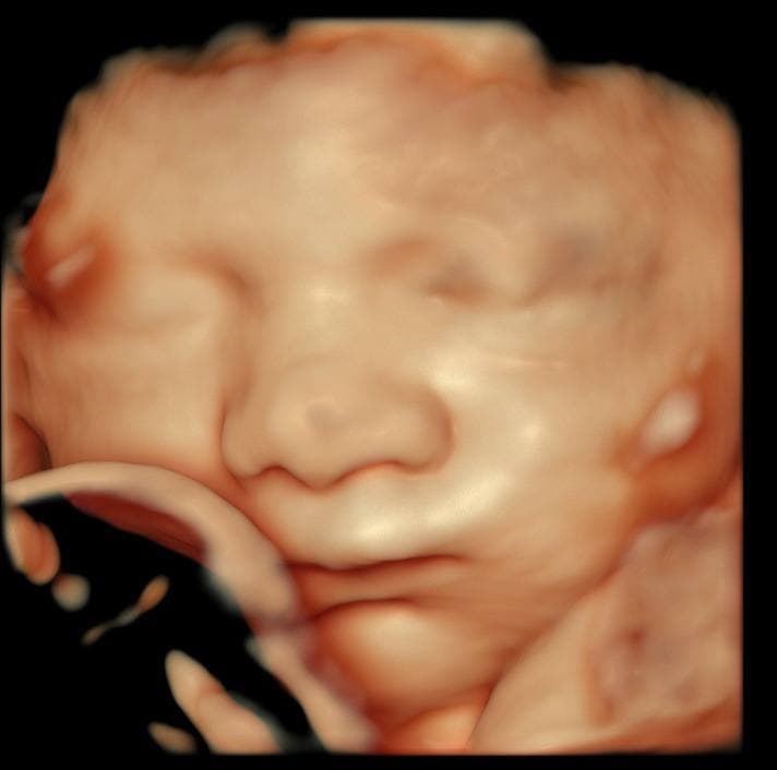 Good fluid baby ultrasound, clear face