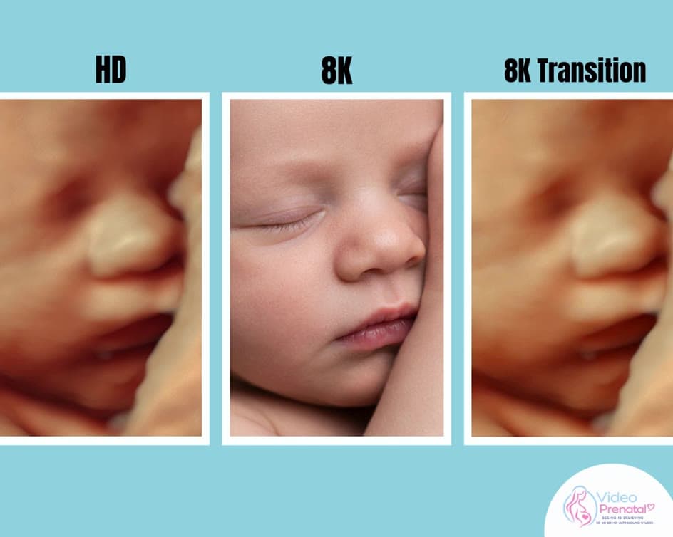 Side by side comparison of a sleeping baby in HD ultrasound, as an 8K hyperrealistic image and as a transition between them
