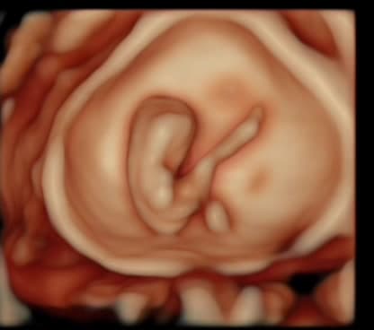 HDlive 3D ultrasound close-up of a baby's ear and cheek during an elective keepsake session