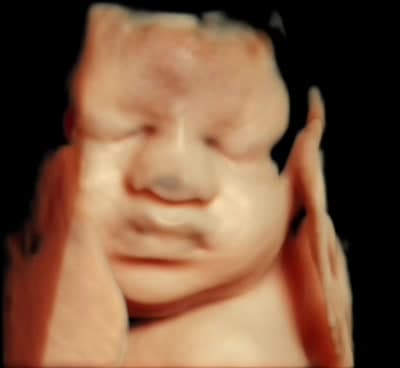 HDlive 3D ultrasound of a baby resting its face between both hands