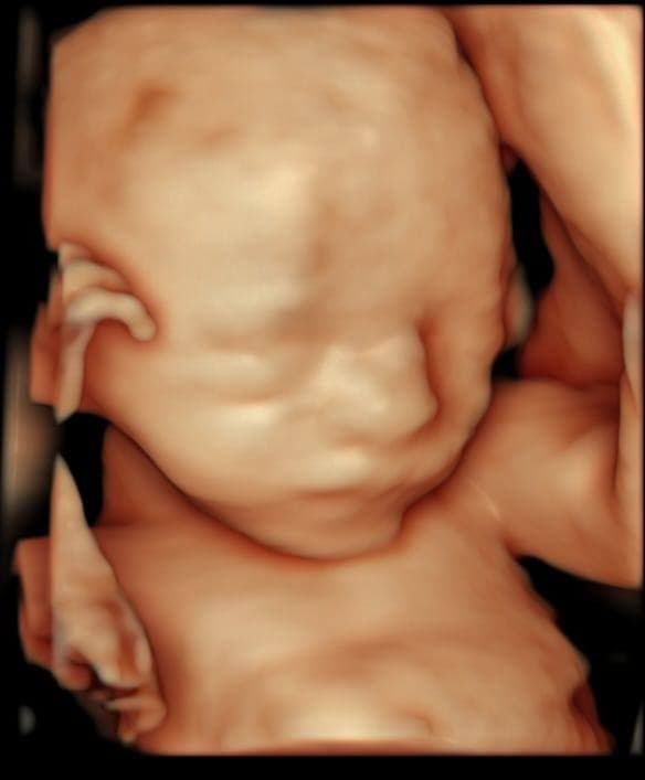 Video Prenatal 5D Sneak Peek