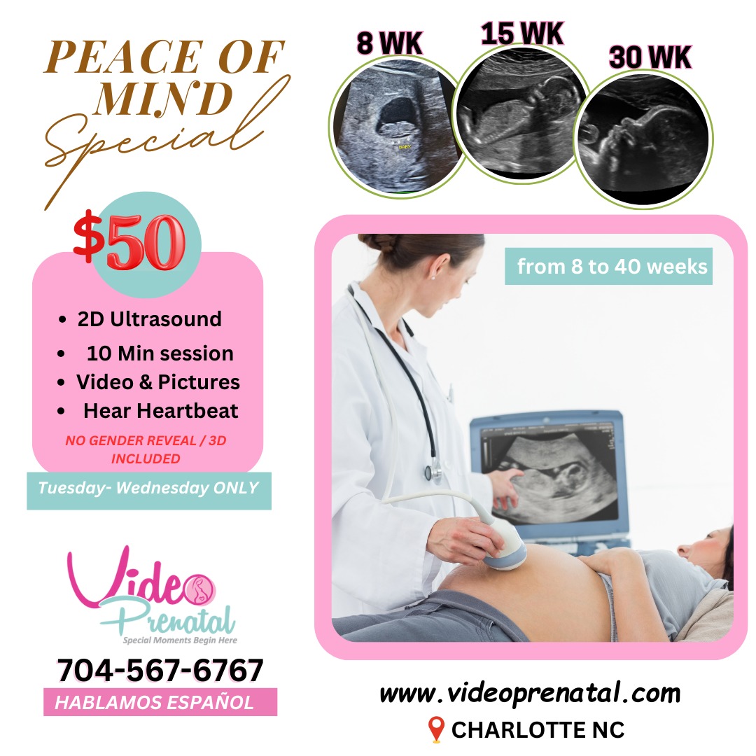 Start your year with the "Peace of Mind Special" at Video Prenatal! Every Tuesday and Wednesday, enjoy a 10-minute 2D ultrasound session for just $50. Capture unforgettable moments with video and pictures included, and listen to your baby’s heartbeat as early as 8 weeks. This midweek deal is perfect for expecting parents who want to connect with their little one in a calm and welcoming environment. Please note: no gender reveal or 3D options are included. This exclusive offer is available only on Tuesdays and Wednesdays, so don’t miss out! Whether you’re 8 weeks or 40 weeks along, we’re here to provide you with a comforting and memorable experience. Book your session today and let us help you cherish these special moments. Call us or visit our website to schedule your appointment now!