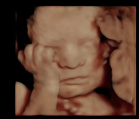 Video Prenatal - GOLDEN MEMORIES.