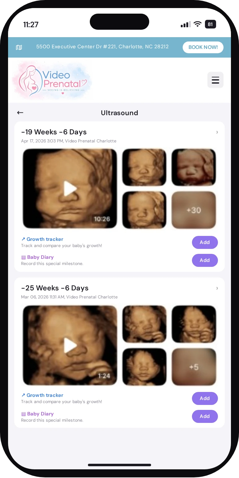App Bomee mostrando las ecografías de Video Prenatal: imágenes y videos de cada ecografía, Growth tracker y Baby Diary